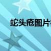 蛇头疮图片初期图片大全（蛇头疮图片）