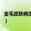 金毛皮肤病怎么治疗最好（金毛皮肤病怎么治）