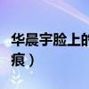 华晨宇脸上的疤在左还是右（华晨宇眼角的疤痕）