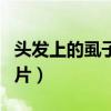 头发上的虱子长什么样子（头发上的虱子卵图片）