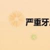 严重牙周炎图片(牙周炎图片) 严重牙周炎图片(牙周炎图片)