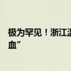 极为罕见！浙江温州发现一例比“熊猫血”更稀有的“恐龙血”