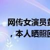 网传女演员黄日莹武训时受伤，脸部缝了7针，本人晒照回应