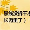 黑线没拆干净长肉里了怎么办（黑线没拆干净长肉里了）