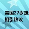 美国27岁蛙后像大妈，离奇衰老可疑 背后真相引热议