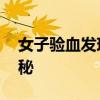 女子验血发现自己有两种血型 奇美拉现象揭秘