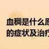 血稠是什么原因?有什么办法能解决吗?（血稠的症状及治疗）