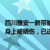 四川雅安一脐带胎盘未剪婴儿被村民捡到 当地民政局：孩子身上被晒伤，已送医救治